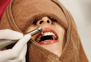 STEP 3：歯面のクリーニング