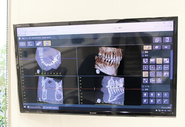 歯科用CTを用いた診断
